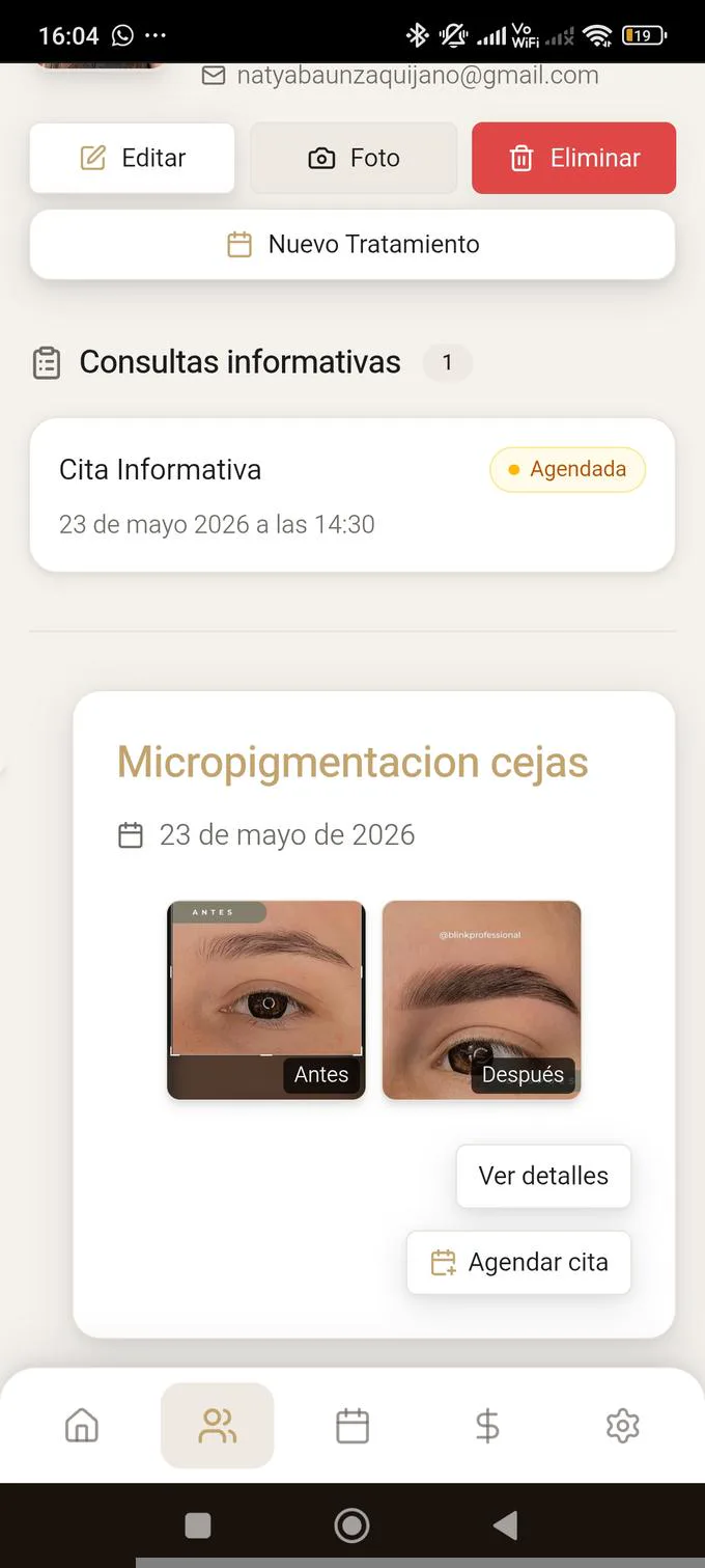 PMUSmart — Fotos antes y después